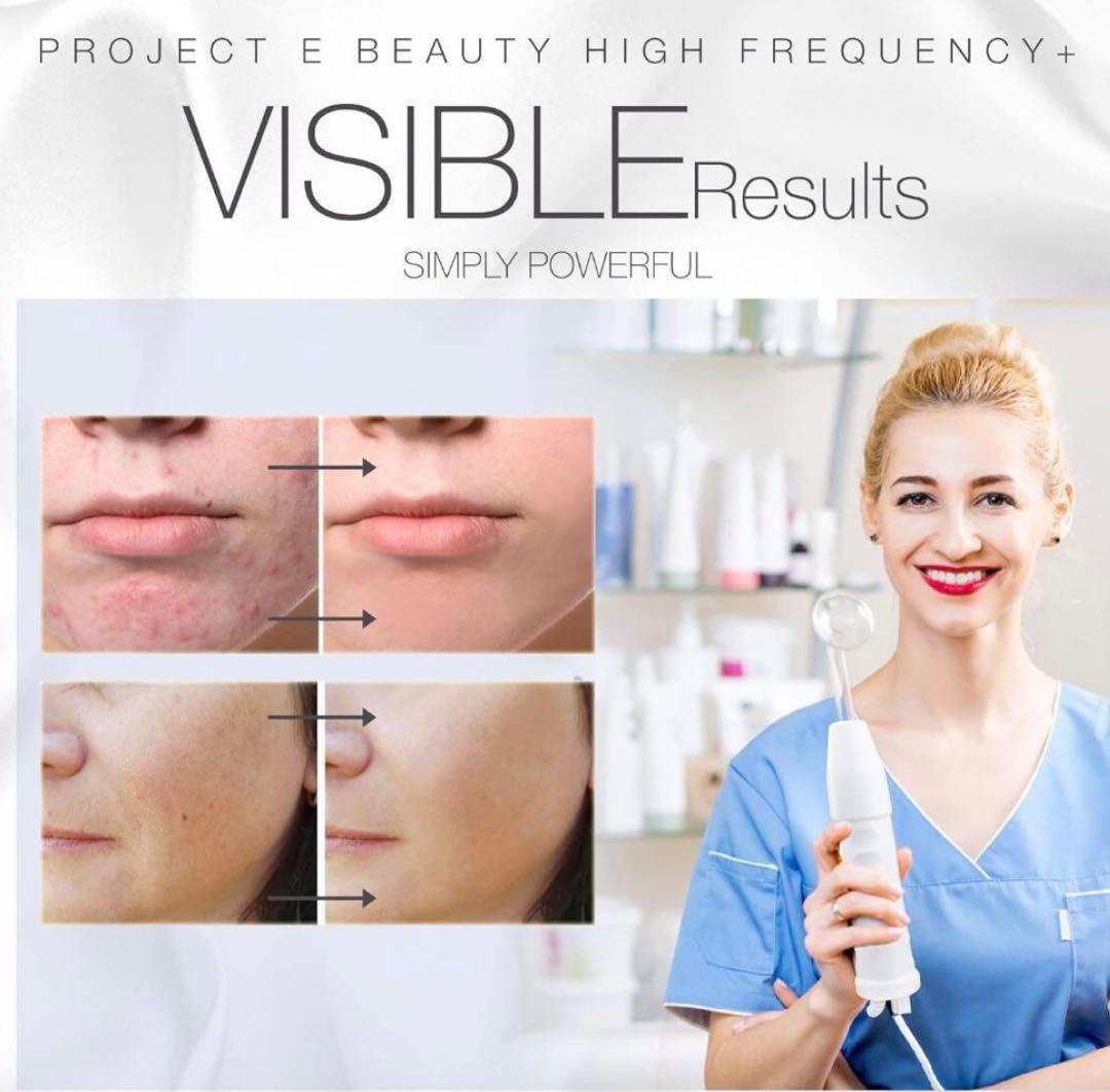 プロジェクトEビューティー高周波デバイス スキンケアデバイス