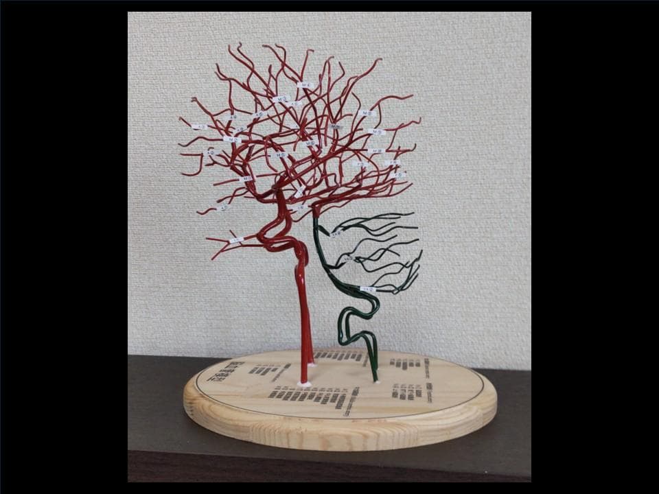 脳血管（内頸動脈、椎骨動脈）模型