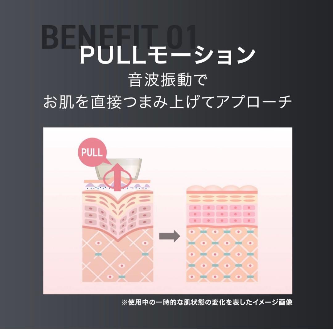 美顔器 INGRACE Pullquart MBE104A (ブラック)