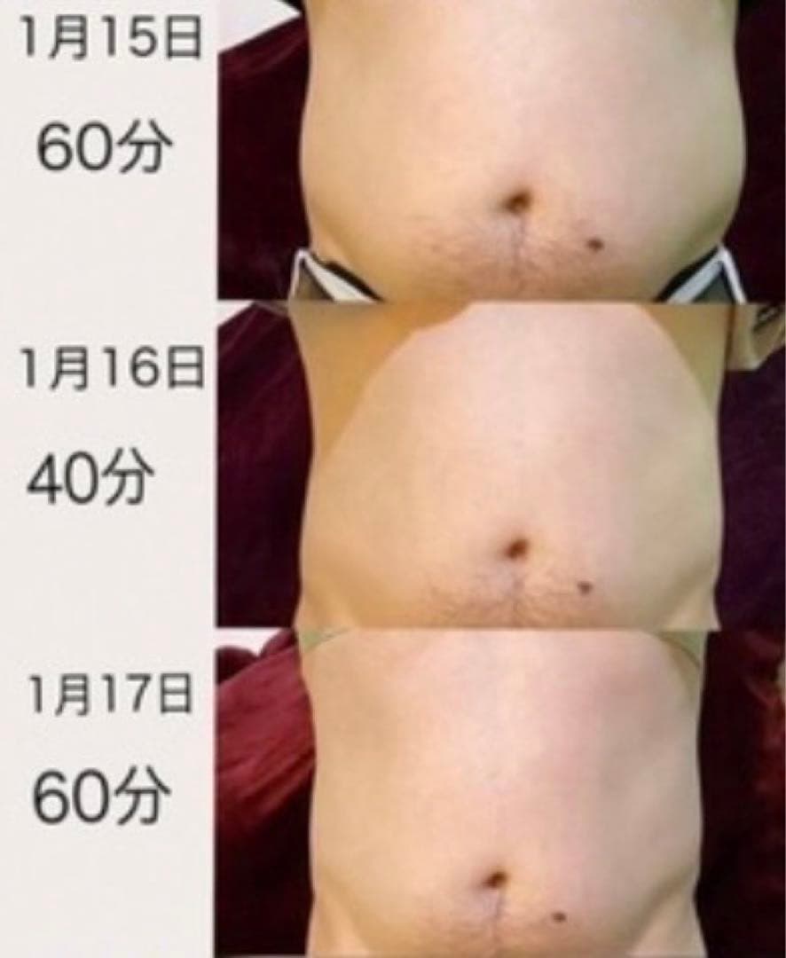 痩身機/業務用痩身マシン/EMS/電磁パルス/筋トレ/エムスレンダー